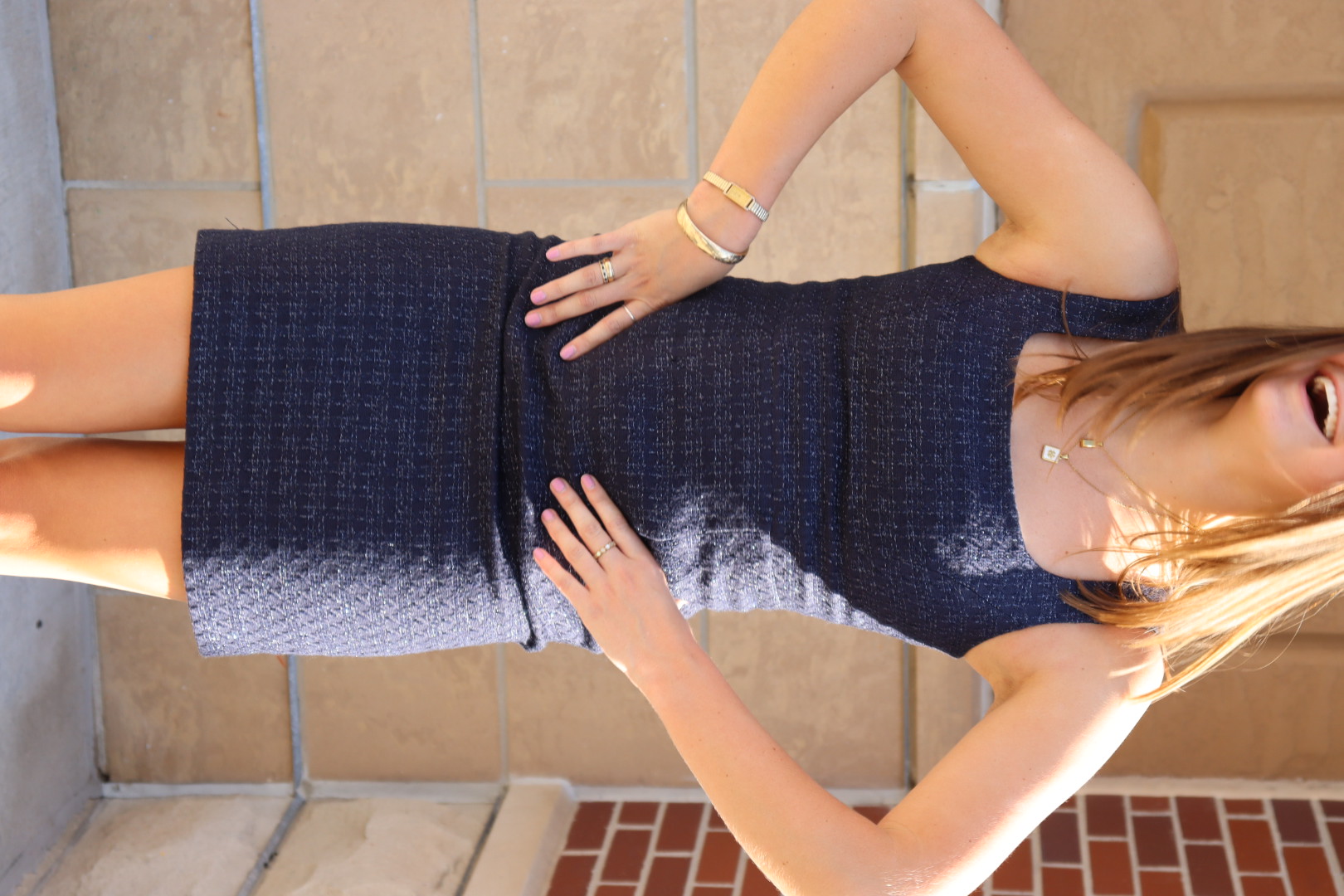TORY BURCH DRESS view 2