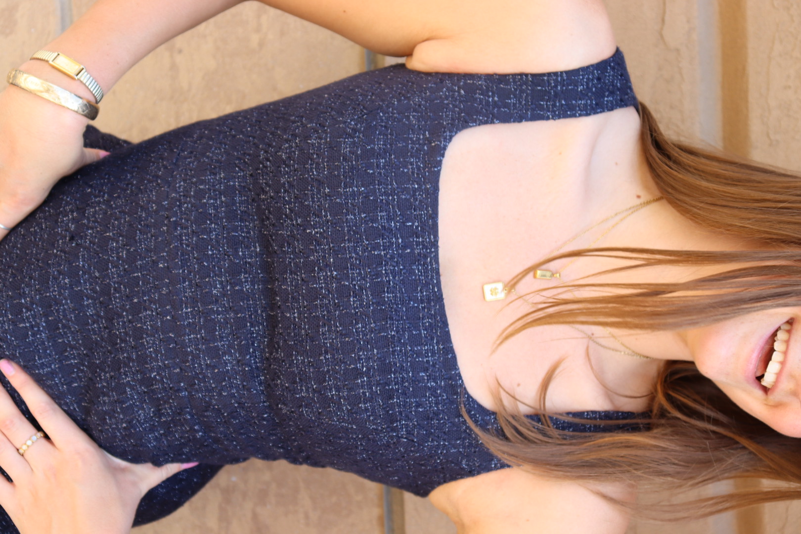 TORY BURCH DRESS view 6
